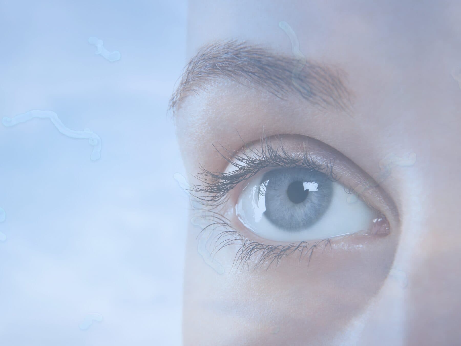 Kdaj svetujem lasersko odstranitev motnjav v očesu?